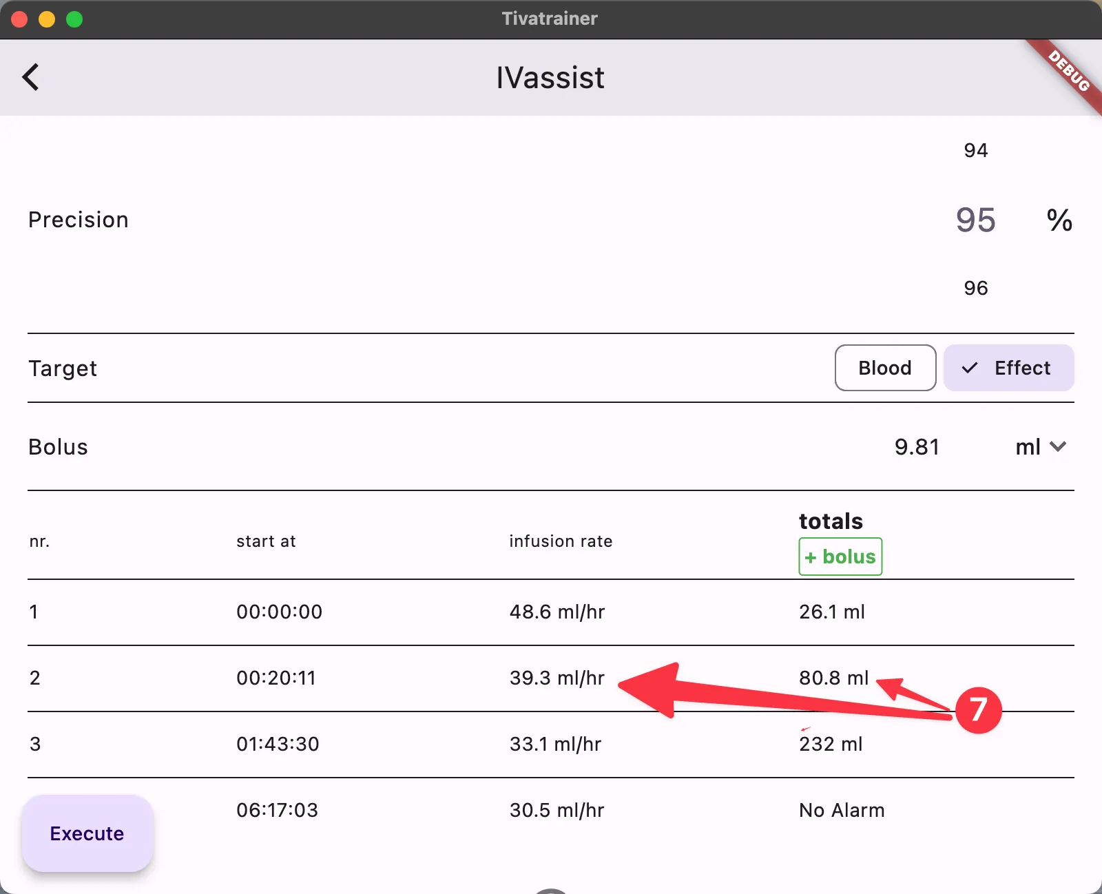 IVassist simulation
